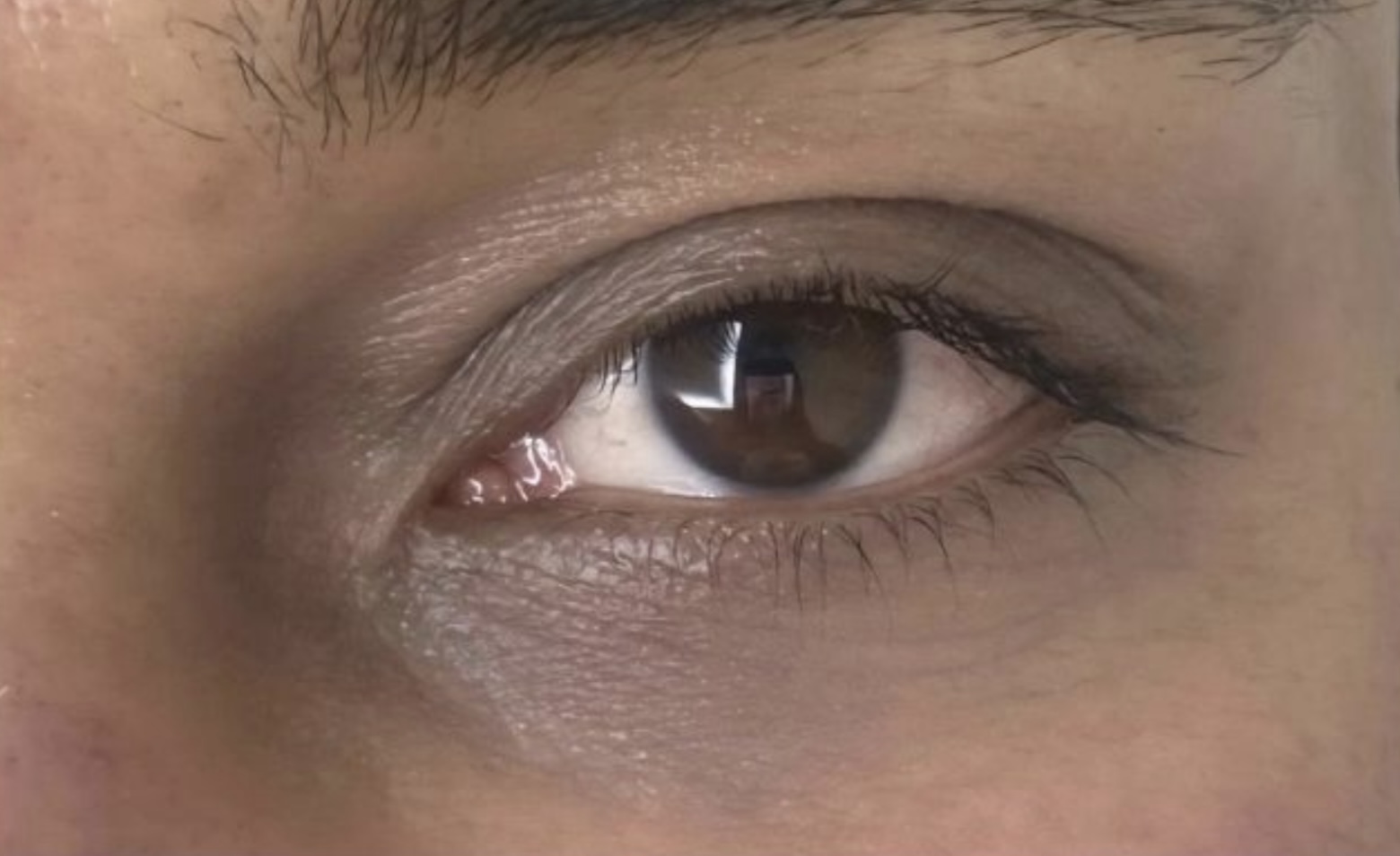 Before Under Eye Salmon DNA